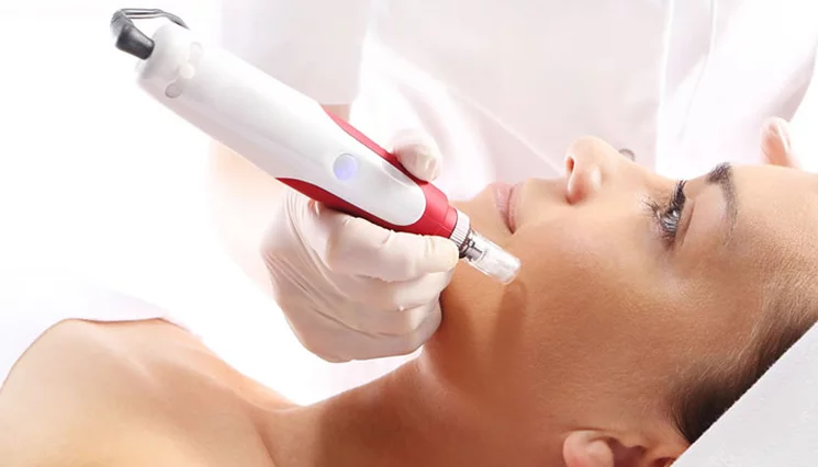 Microneedling | Toronto Acne Scar Reduction (Acne,Scars,Anti-aging)