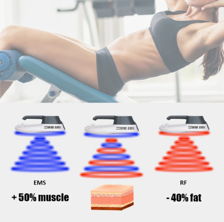 emszero body contouring treatment benefits