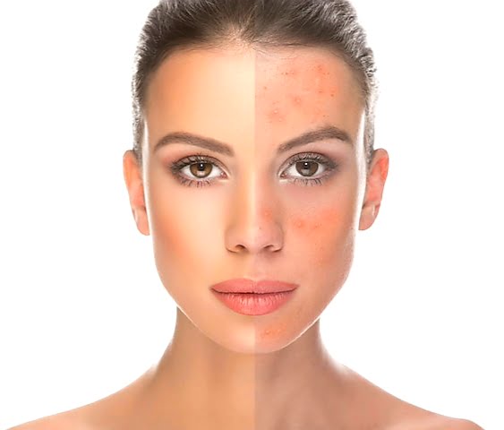 DMK Skin Care Facial Service Toronto